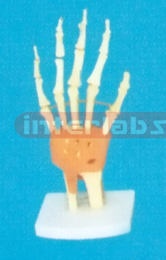 ADVANCED BIG LEFT ARM JOINT-FUNCTIONAL MODEL WEST-TYPE